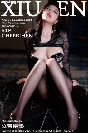 [XIUREN秀人网]2025.11.26 No.11035 CHENCHEN[81P854M]